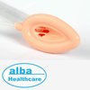 ALBA Healthcare/ АЛЬБА Хелскейр маска ларингеальная силиконовая; Размер: 4.0
