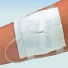 Vliwasoft® Split Dressing/ Фливасофт Сплит Дрессинг стерильные мягкие нетканые дренажные салфетки c Y-образным вырезом от компании Lohmann & Rauscher (L&R)/ Ломанн и Раушер; 7,5х7,5 см; 4 слоя; 100 шт/уп (50х2)